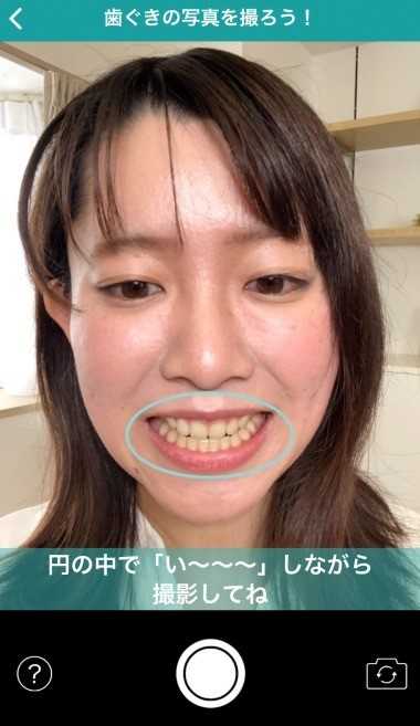 口腔疾患を発見する機能を用いたデモアプリ
