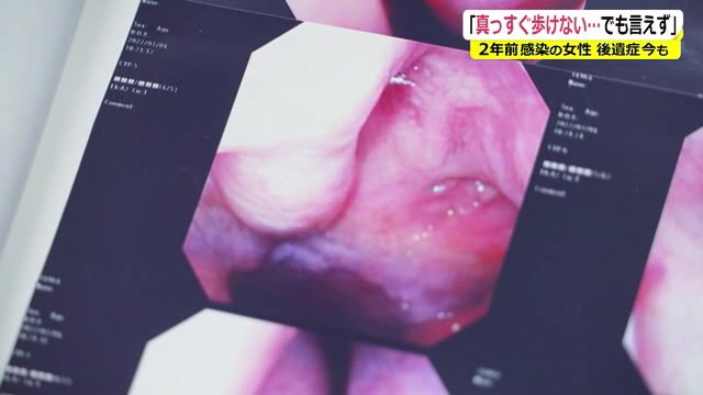 腫れて炎症を起こした喉