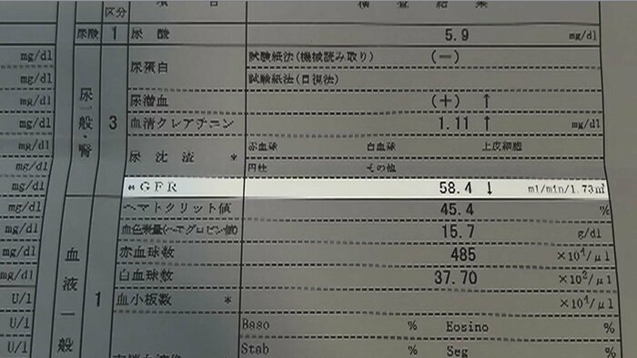 男性「コレステロール値を下げられないかと思い飲んでいた。腎機能の低下はそのままで、医師からは80代くらいの腎臓だと言われた」