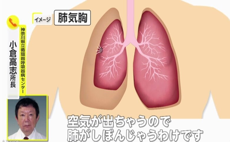神奈川県立循環器呼吸器病センター・小倉高志所長