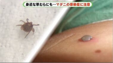 致死率30%…草むらに潜む脅威 「マダニ感染症」広がる ペットも死亡の危険あり【静岡発】