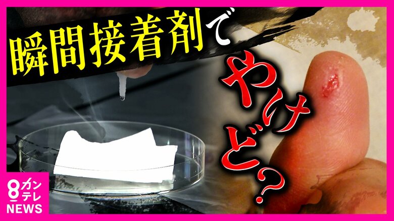 『瞬間接着剤』やけどに注意　“つけ爪用の接着剤”で子供がやけどする事故も　衣服などに付着した際は大量の水をかけて｜FNNプライムオンライン