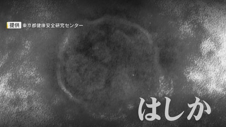 脳炎や肺炎などの合併症を引き起こす恐れ『はしか』 “最強クラス”とされる感染力 成人もワクチン接種を 【福岡発】|FNNプライムオンライン