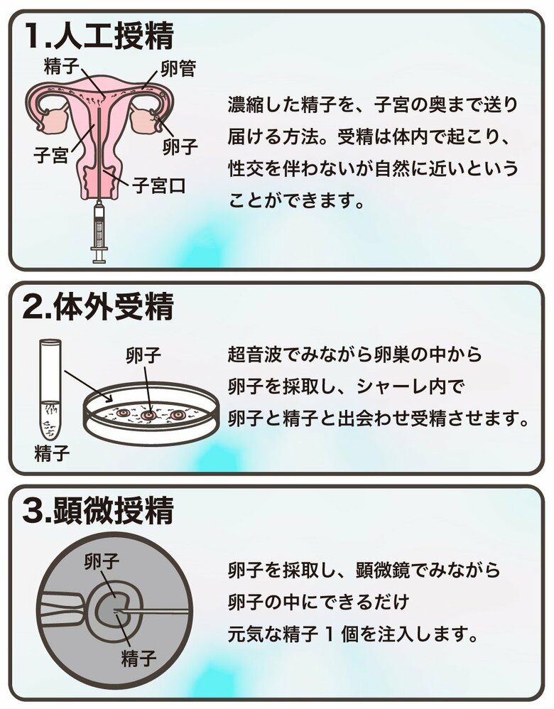 図１保険適用される不妊治療（図解イラスト：さいとうひさし）