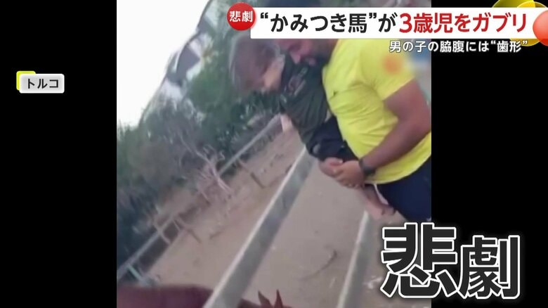 3歳の男の子が馬にかまれる事故（トルコ・アルタンヤ）