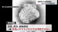 重症化すると深刻な症状も…7年ぶりに宮崎市で確認されたはしか　注意点は