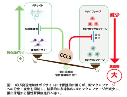 慢性腎臓病が進行するメカニズムの一端を解明~ケモカインであるCCL5の慢性腎臓病における相反する役割を発見~