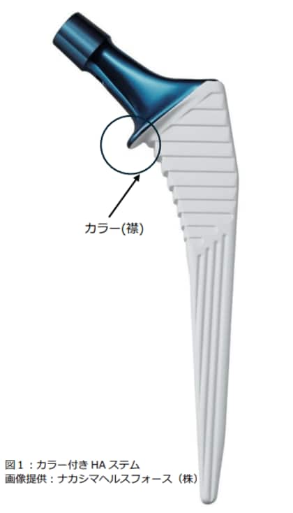 人工股関節全置換術後の骨折予防に新展開?-カラー(襟)付きHAステムの有効性に期待-
