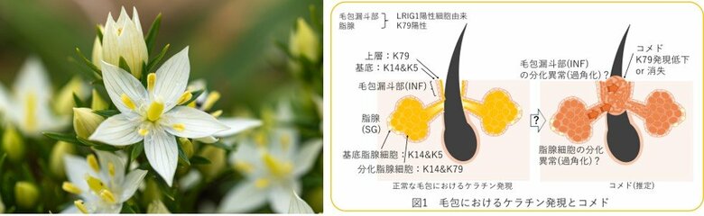 センブリエキスにケラチン79発現を回復する効果を発見。ニキビ(尋常性ざ瘡)予防への活用が期待