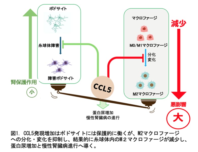 慢性腎臓病が進行するメカニズムの一端を解明~ケモカインであるCCL5の慢性腎臓病における相反する役割を発見~