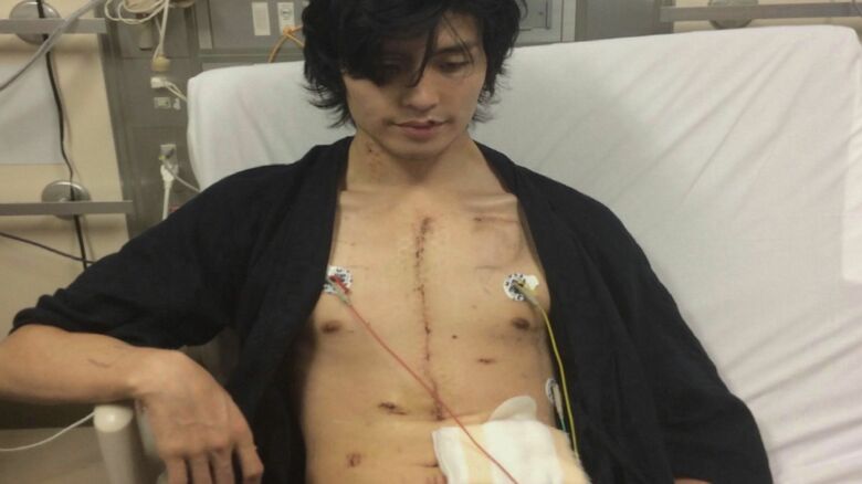 補助人工装置を入れた当時の森原大紀さん