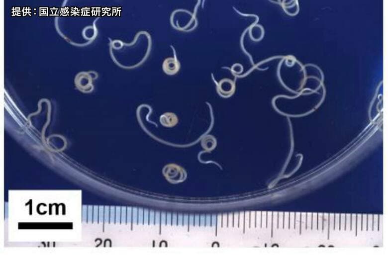 仙台の居酒屋で刺身食べた男性がアニサキス食中毒　市が１日間の営業制限処分｜FNNプライムオンライン