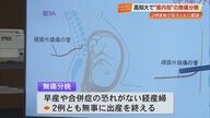 【高知】全国最後、県内初の無痛分娩　高知大で実施、2例とも「無事に出産を終えた」