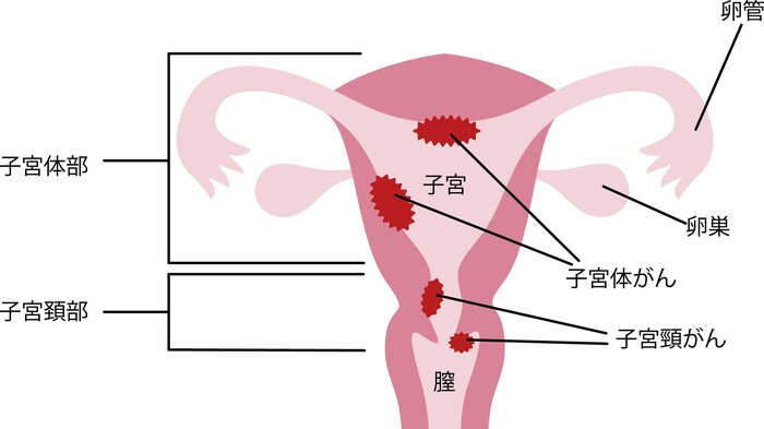 （画像はイメージ）