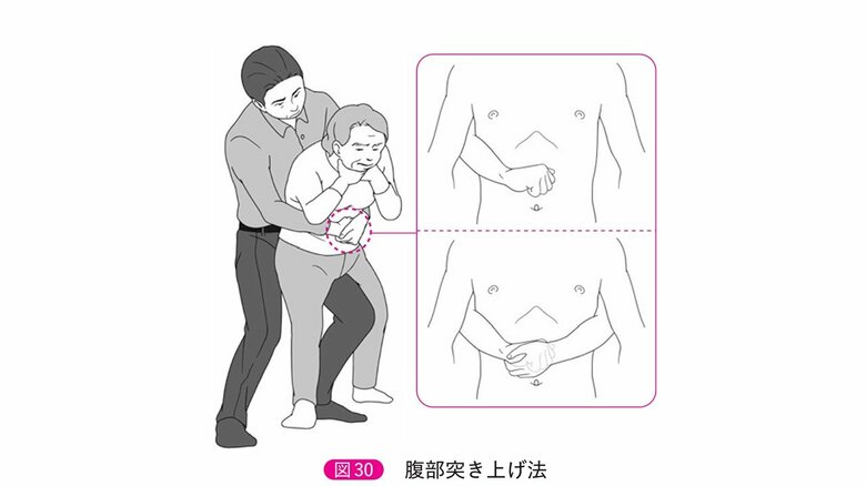 腹部突き上げ法（「改定6版　救急蘇生法の指針2020（市民用）」より）