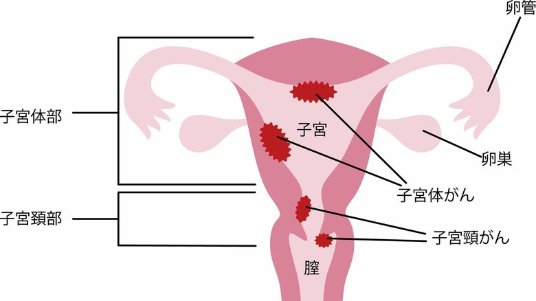 （画像はイメージ）