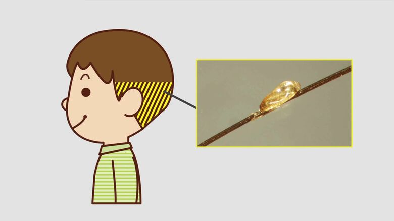 髪の毛の根元近くを要チェック