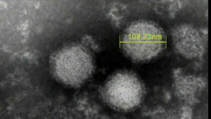【何が】「SFTS（重症熱性血小板減少症候群）」にかかった猫の治療にあたっていた獣医師が死亡　マダニが媒介する感染症もかまれた痕無し…感染経路不明