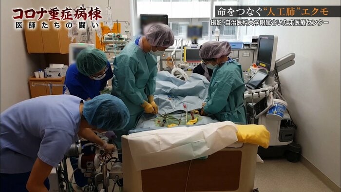 ECMOの回路交換作業