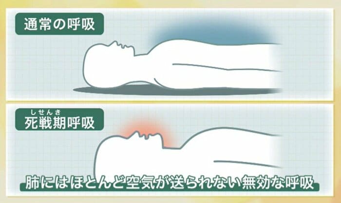 心停止直後に見られる死戦期呼吸では、ほとんど肺に空気が送られていない