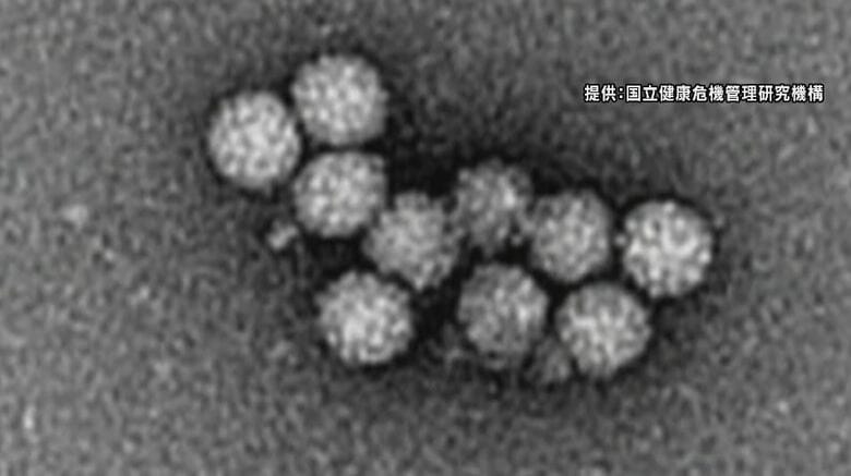 患者が急増…全県に「ノロウイルス食中毒注意報」　長野県｜FNNプライムオンライン