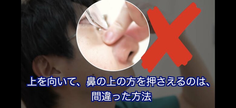 上を向いて、鼻の上の方を押さえるのは間違った方法（提供：一般社団法人 日本耳鼻咽喉科頭頸部外科学会）