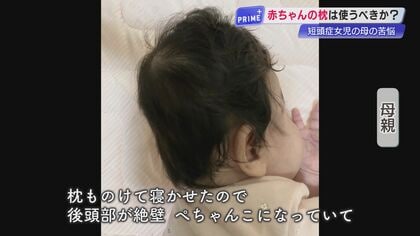 「枕なし」を信じたのに…赤ちゃんの頭がぺっちゃんこ、枕は必要か？国や医師の見解が真っ二つ