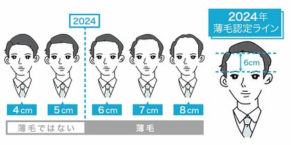 全国4,700名が本気で回答!「2024年版 薄毛の境界線」を発表眉毛上から生え際6cmで薄毛認定、20代は5cm台と見た目に厳しく薄毛に最も厳しい都道府県は“愛知県”、最も寛容なのは“長野県”