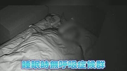 あなたは大丈夫？ 睡眠時「無呼吸」のリスク  肥満の人がかかるイメージだが…  痩せ体型でも危険 【福岡発】