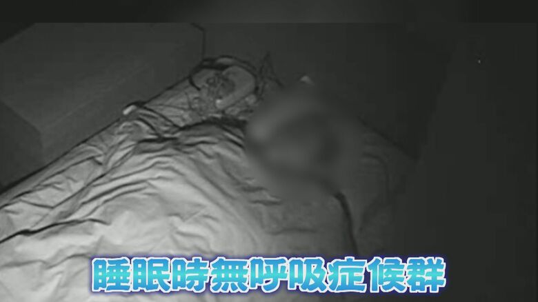 あなたは大丈夫？ 睡眠時「無呼吸」のリスク  肥満の人がかかるイメージだが…  痩せ体型でも危険 【福岡発】｜FNNプライムオンライン