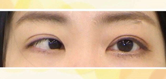 提供：CS眼科クリニック