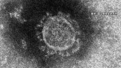 【新型コロナ】長野市で新たに6人感染　「集団感染」の病院関連2人増えて47人　県内の感染累計1146人に