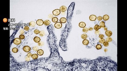 ヒトからヒトへの感染の可能性　クルーズ船でハンタウイルス