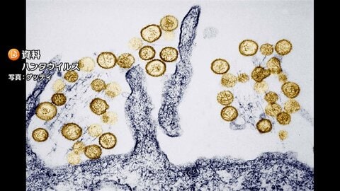 ヒトからヒトへの感染の可能性　クルーズ船でハンタウイルス