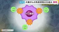 大腸がんが免疫療法で“治りにくい”のは“免疫細胞の侵入防ぐ”タンパク質が原因か　京都大学の研究グループが初めて解明