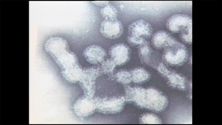 鳥インフルエンザ