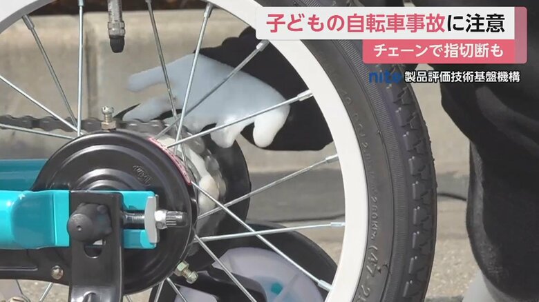 指が切断されてしまった