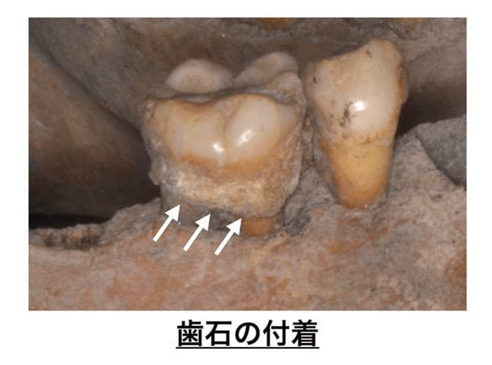 （出典：東京医科歯科大学）