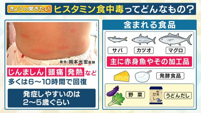 ヒスタミン不耐症の人はどうなるでしょうか?