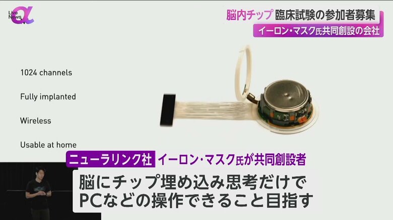 脳にチップを埋め込む臨床試験の参加者募集が始まった