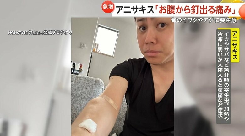 「NON STYLE」の井上裕介さんもアニサキスによる食中毒に…