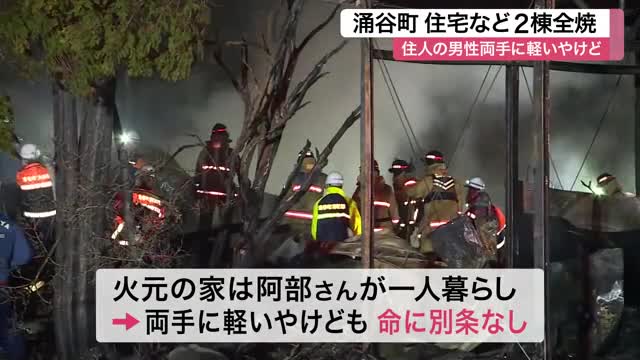 涌谷町で住宅など２棟が全焼する火事 一人暮らしの７３歳男性が両手にやけど　軽トラック２台焼失〈宮城〉