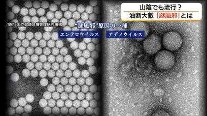 なんとなく風邪っぽい…山陰でも増加「謎風邪」子ども中心に長引く体調不良「油断大敵」早期受診を
