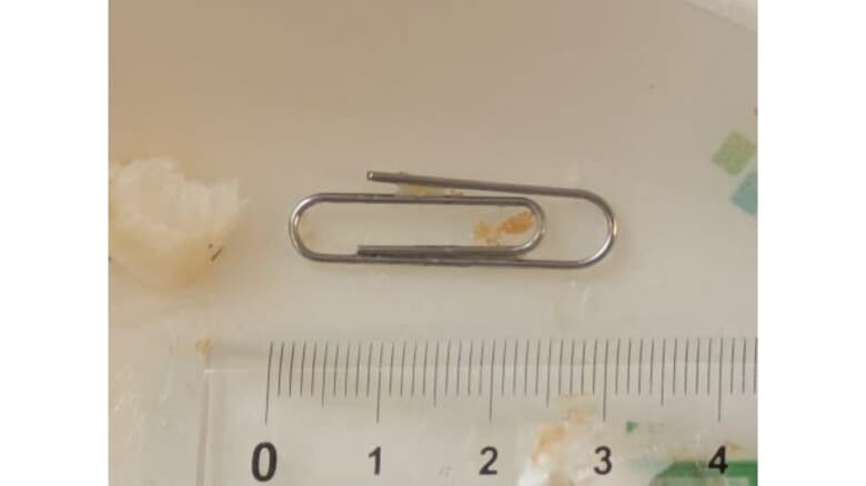 白身魚フライに3センチの金属クリップ…津和野町内の小学校の給食に異物混入　健康被害の報告なし（島根）｜FNNプライムオンライン