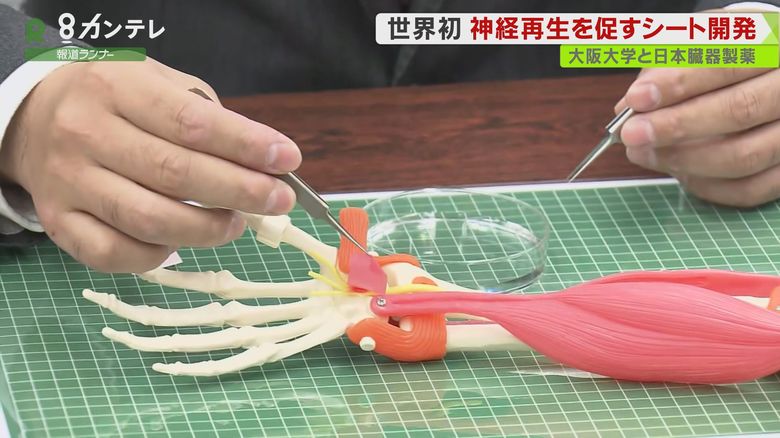 ”世界初”…神経の「再生」を促す「治療用シート」を開発 大阪大学と日本臓器製薬などの研究グループ