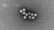 「感染性胃腸炎」「溶連菌」の患者が増加　溶連菌は前週の1.5倍　手洗いなど感染対策を呼びかけ　長野県　　