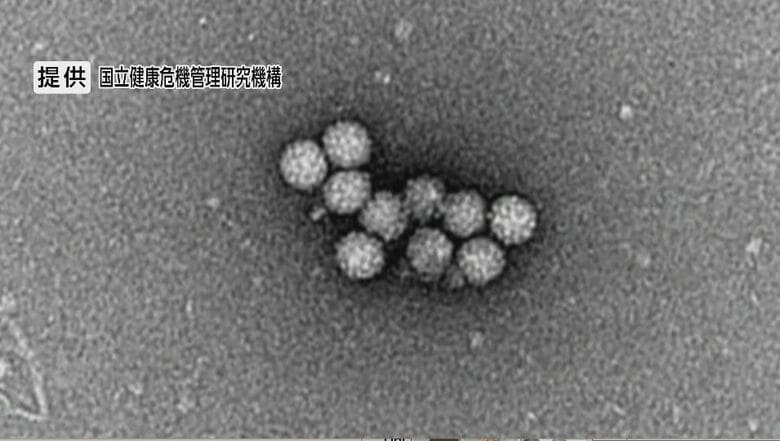 「感染性胃腸炎」「溶連菌」の患者が増加　溶連菌は前週の1.5倍　手洗いなど感染対策を呼びかけ　長野県　　｜FNNプライムオンライン