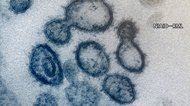 新型コロナ 東京都で新たに1592人の感染確認 重症者は138人