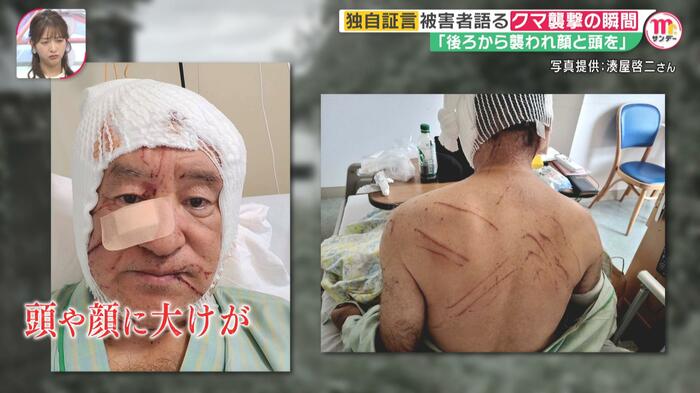 頭や顔に大けがを負った湊屋啓二さん(本人提供)
