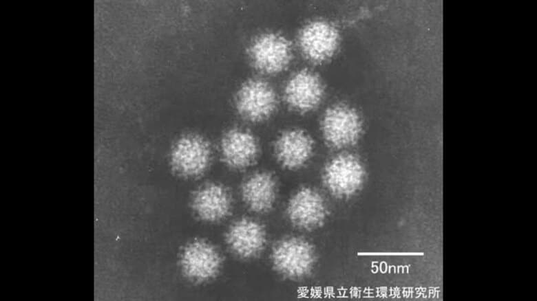 入居者１５人が症状訴え　今治市のサ高住「おあしす中央」で食中毒　調理場を４日間調理業務停止【愛媛】｜FNNプライムオンライン